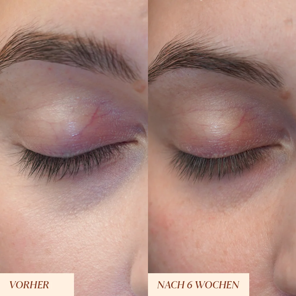 Peptide Wimpernserum