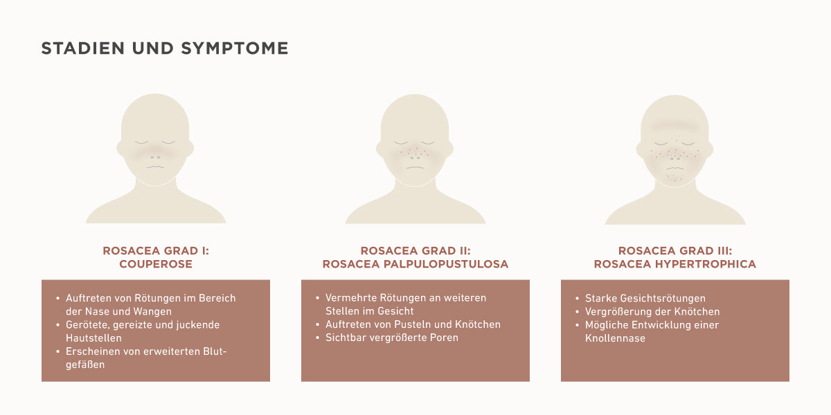 rosacea, couperose