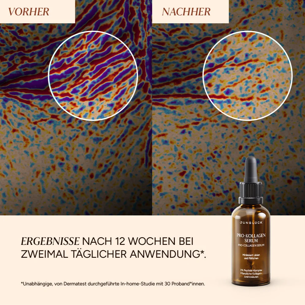 KENNENLERN SET Linien & Falten minimieren