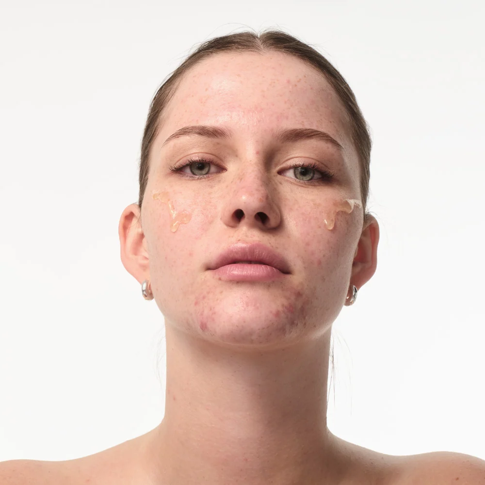 Set Unreinheiten mindern mit SPF