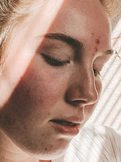 Flaky skin, tips for flaky skin