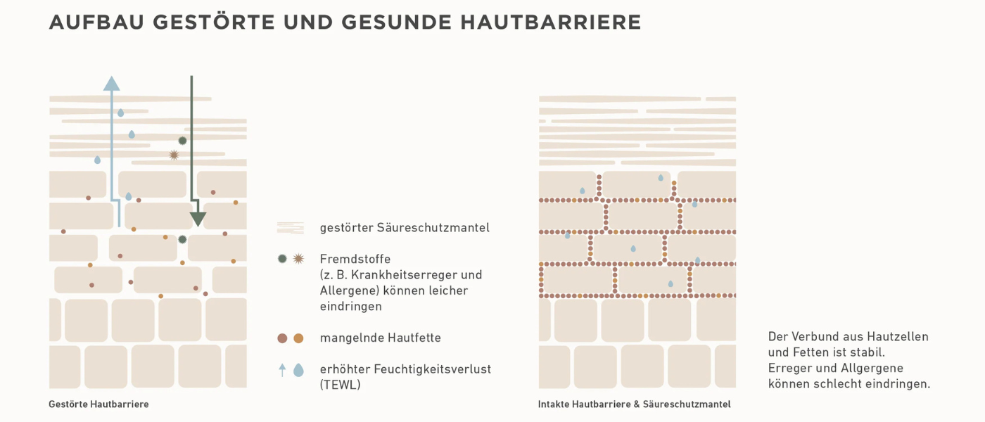 Neurodermatitis skin barrier