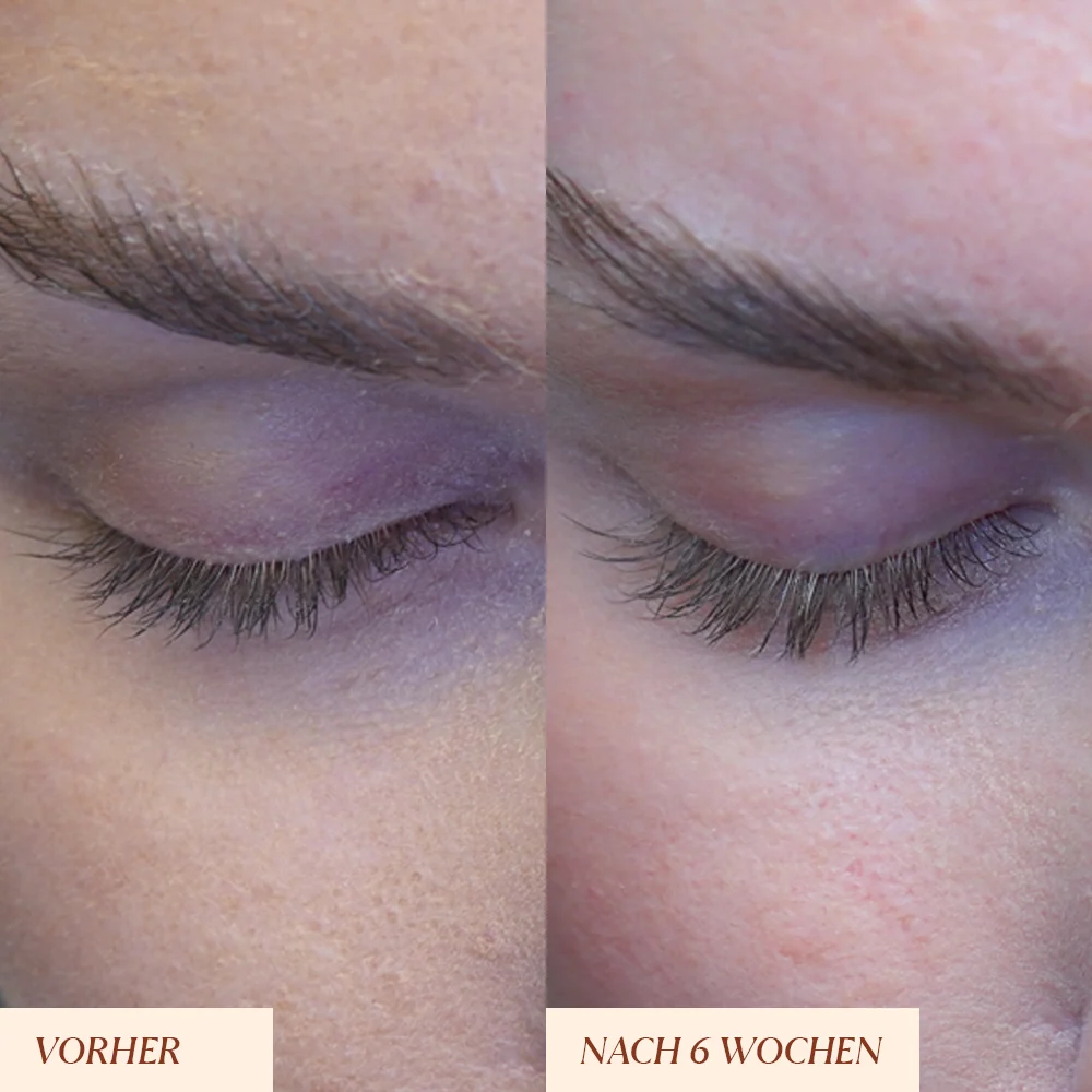 Peptide Wimpernserum