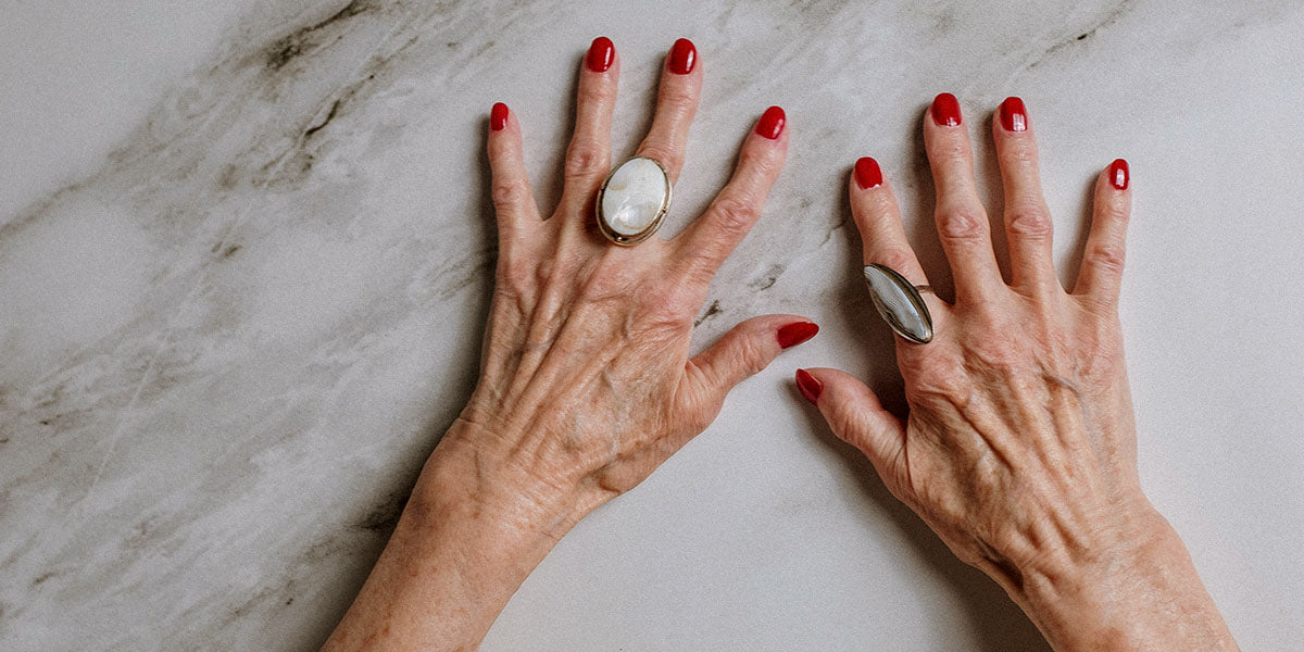 Hands marked by age spots, wrinkles and visible veins.