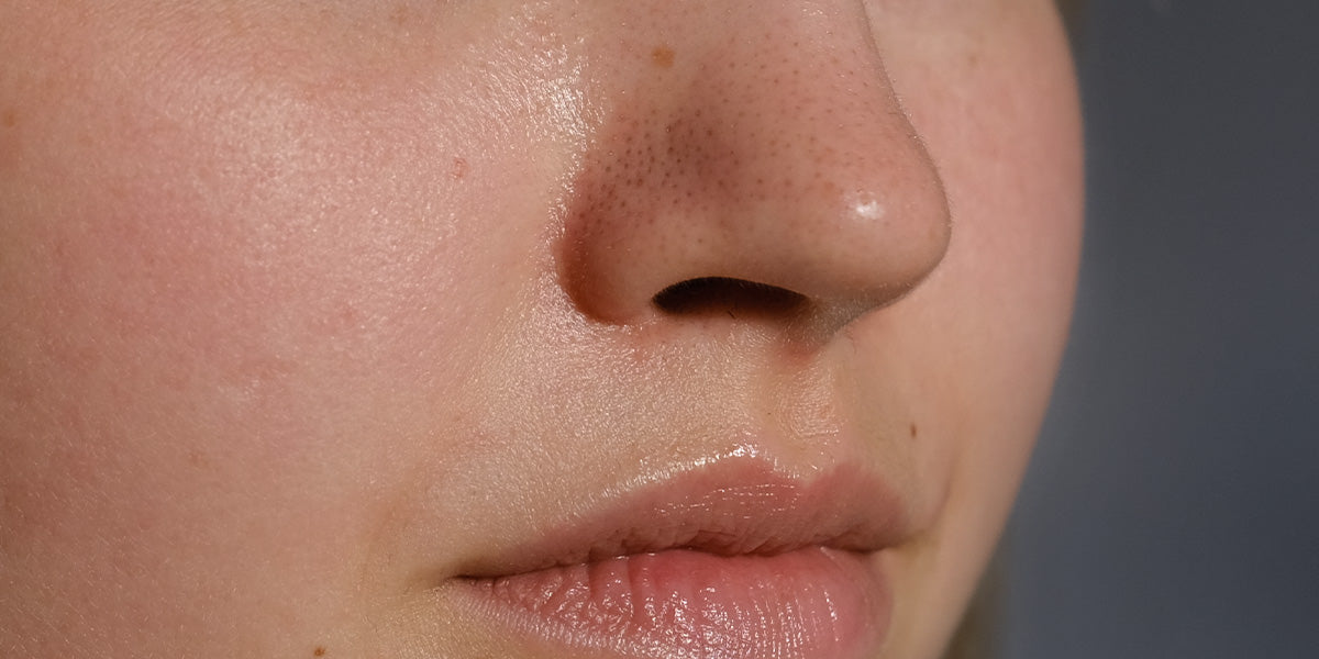 recognize skin type