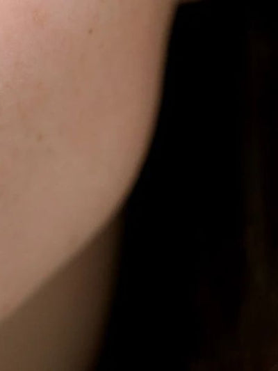 Lower part of the face with spots