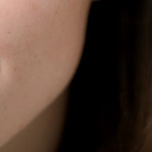 Lower part of the face with spots